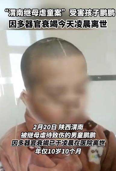 渭南继母虐童案