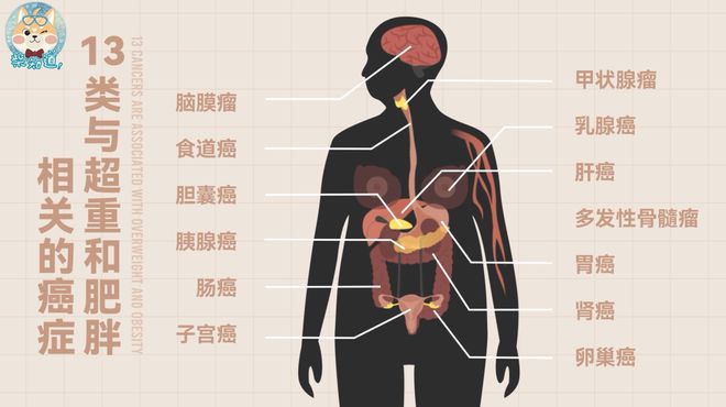 13类与肥胖超重相关的癌症